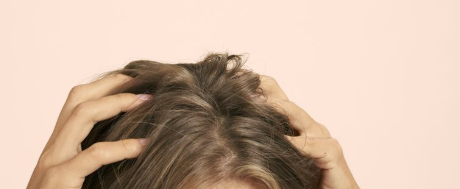 Solución a la pérdida de cabello