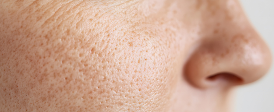 ¿Por qué mis poros se ven tanto?