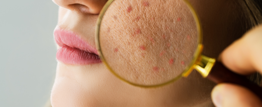 ¿Por qué mi piel tiene textura?