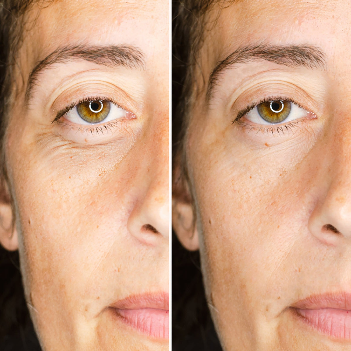 Magic Serum Camaleon Reduce Bolsas Tienda Para Mi